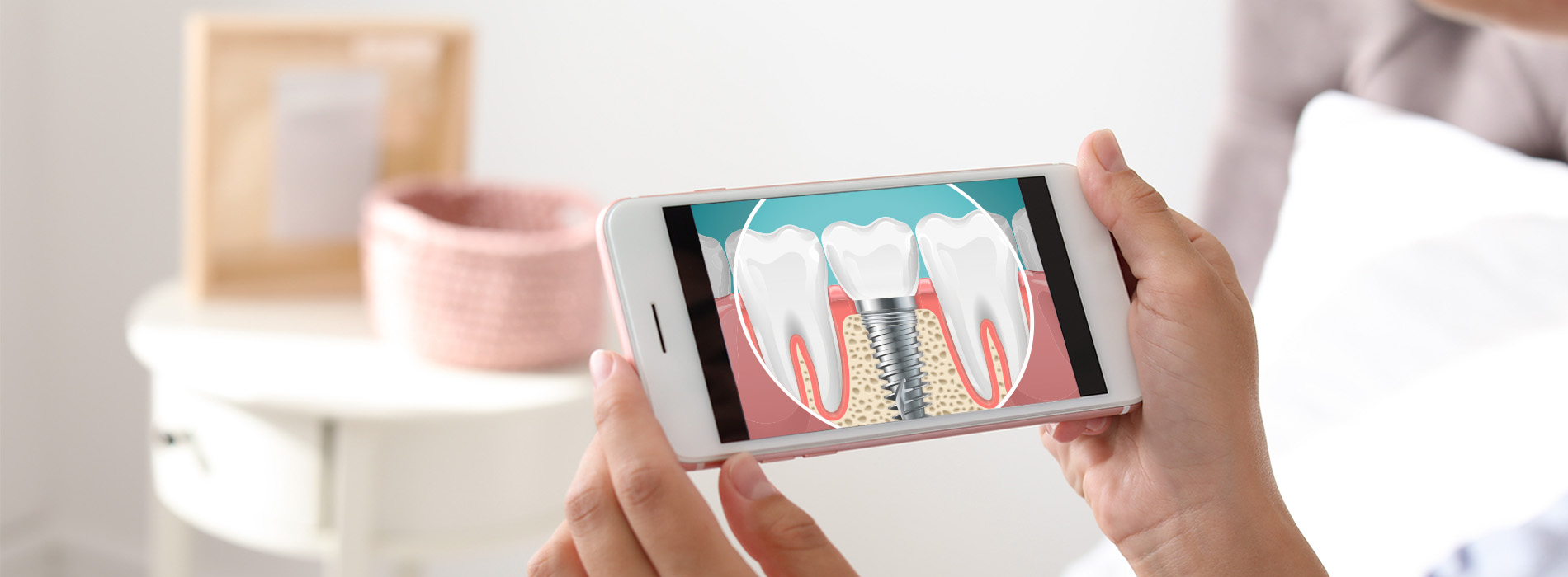 A person holding a smartphone displaying an image of a dental implant.