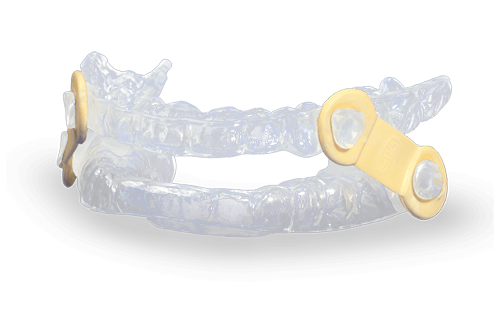 Transparent plastic dental retainer with a clear, water-like appearance.