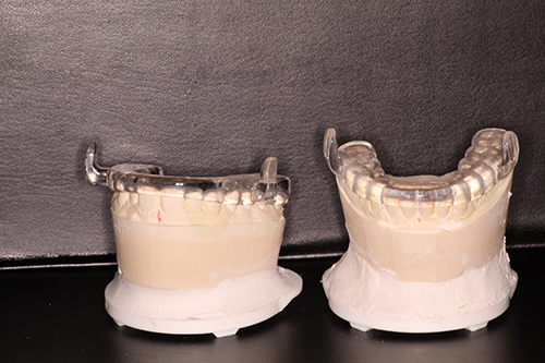 Two clear plastic models of a dentist s mouth guard, placed side by side on a black surface.