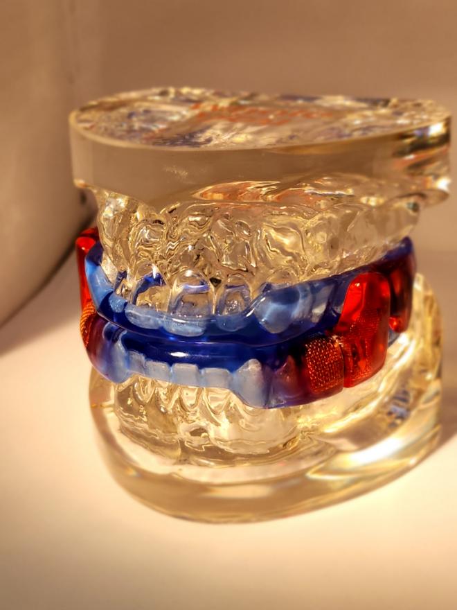 Dr. Robert E. Spatafora | Veneers, TMJ Disorders and Preventative Program