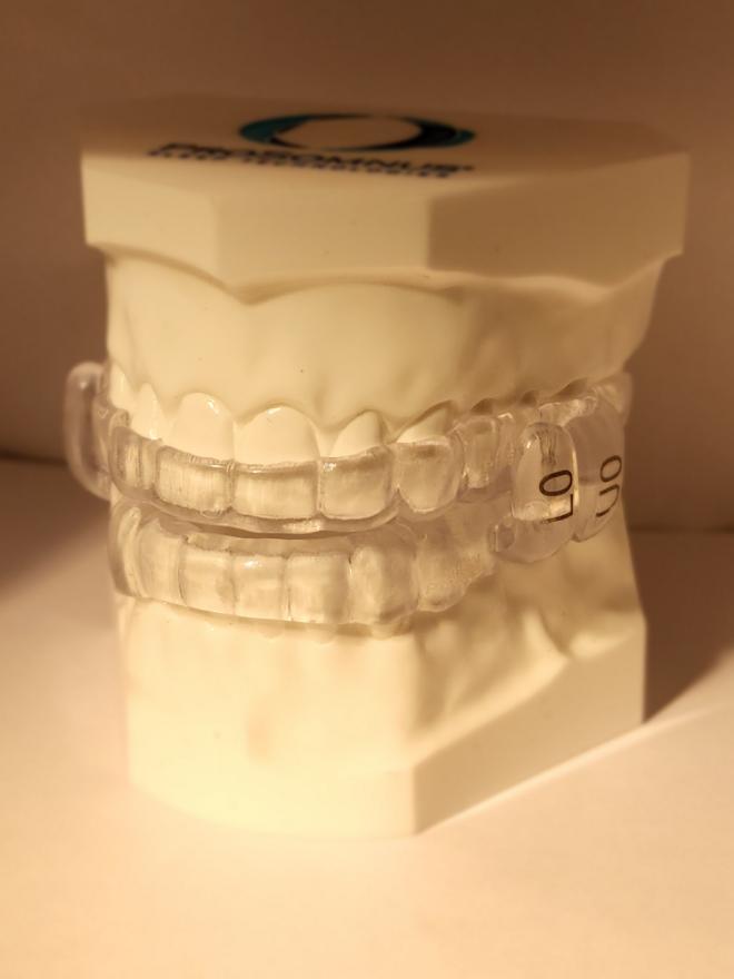 Dr. Robert E. Spatafora | Crowns  amp  Caps, Implant Dentistry and Digital Radiography