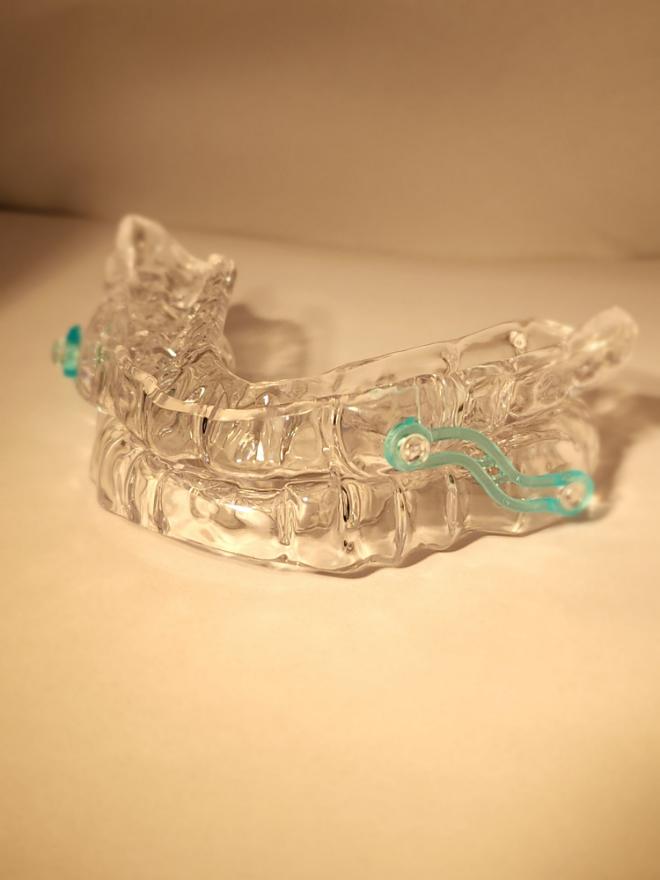 Dr. Robert E. Spatafora | Dentures, Night Guards and Snoring Appliances