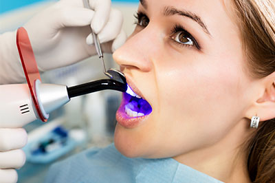 The image shows a person undergoing dental treatment, with their mouth open and a dental device inserted to inspect or clean the teeth.