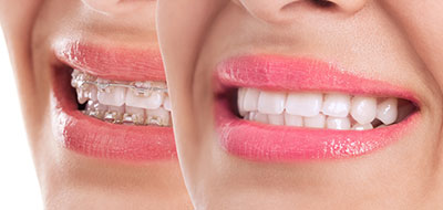 The image is a split-screen photograph featuring two sides of a woman s face, with the left side showing her natural expression and the right side displaying her smile.