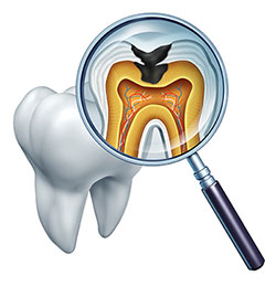 The image shows a magnified view of a tooth with an open mouth, revealing the interior structure including the pulp chamber and root system. A dental mirror is held up to the tooth, reflecting its internal anatomy.