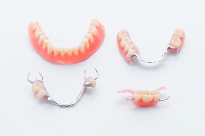 The image shows a set of three teeth with braces, displayed on a white background.