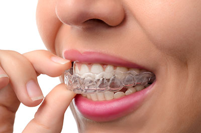 A person wearing a dental retainer, focusing on it with their hand.