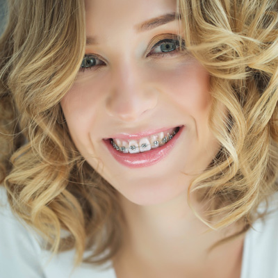 A woman with straight white teeth, wearing braces, smiling and looking directly at the camera.