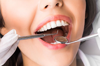 The image shows a woman with a wide smile, holding an object that appears to be a dental implant or prosthetic tooth in her mouth. She is wearing a white lab coat and has a pair of tweezers in her hand, suggesting she may be a dental professional performing a procedure.