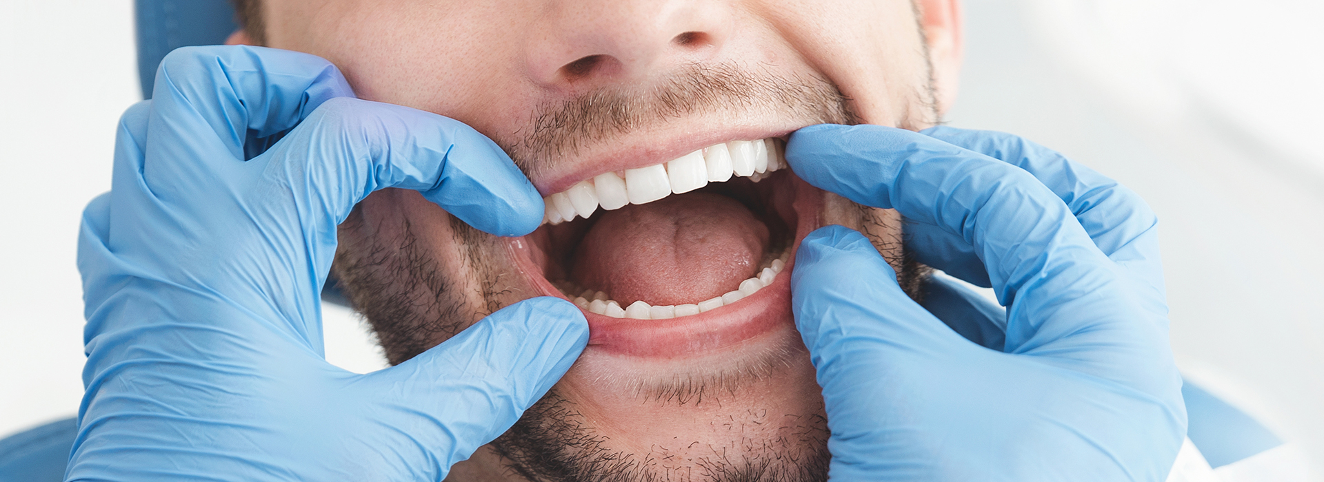 The image shows a person wearing medical gloves and a surgical mask, with their mouth wide open, likely in the process of speaking or performing some dental or oral care procedure.