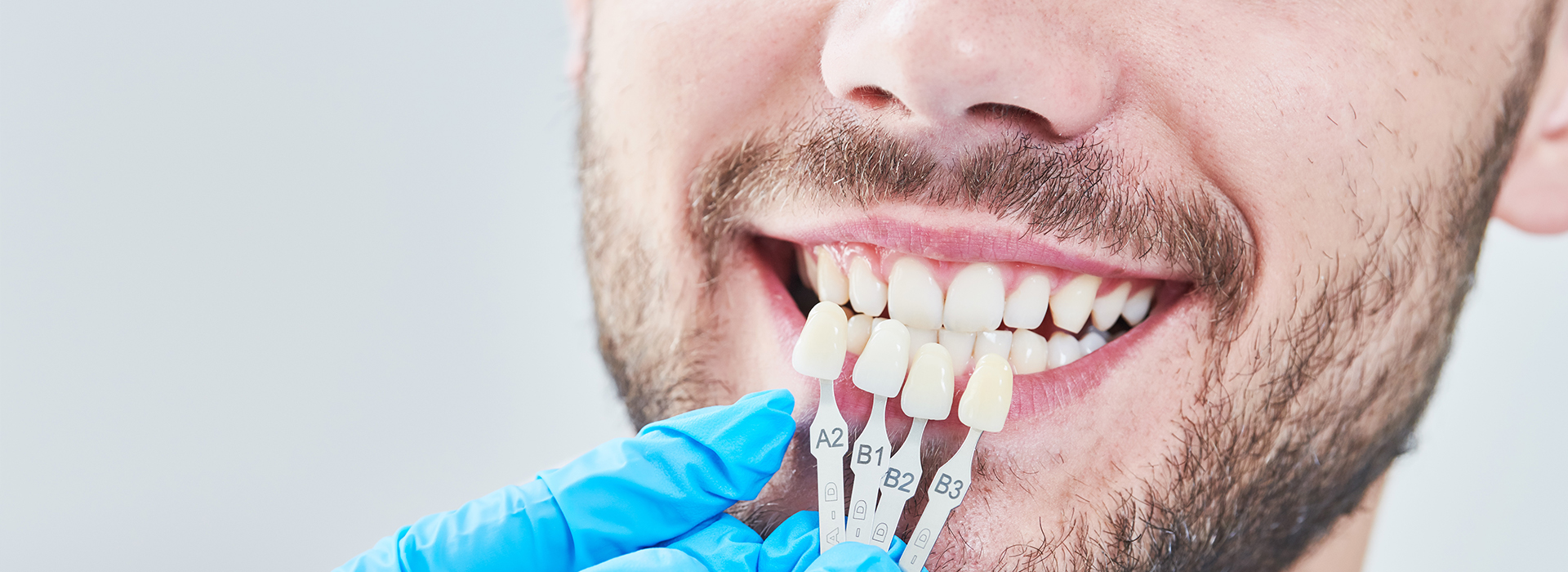 A man with a toothy smile holding dental implants, set against a blurred background.