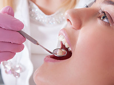 The image shows a dental professional performing a dental procedure on a patient, with the patient s mouth open wide to reveal their teeth and tongue.